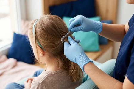 Revision del cabello mechon a mechon en Bye Bichitos